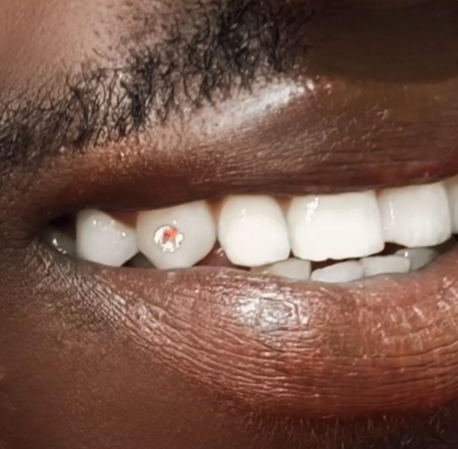 Genuine Clear Swarovski Tooth Gems – Flatback, Non-Toxic | SS5, SS7 & SS9 Sizes