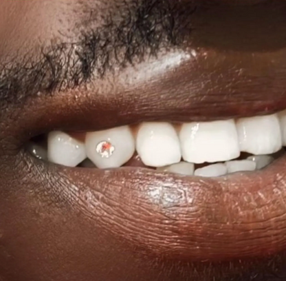 Genuine Clear Swarovski Tooth Gems – Flatback, Non-Toxic | SS5, SS7 & SS9 Sizes