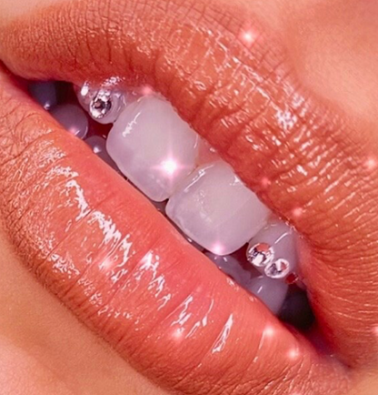 Tooth Gem Kit - PREORDER